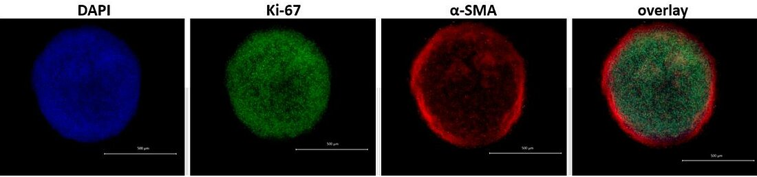 Spheroid unter dem Fluoreszenzmikroskop (Foto: Alina Deipenbrock) Man sieht den Blick durch ein Mikroskop