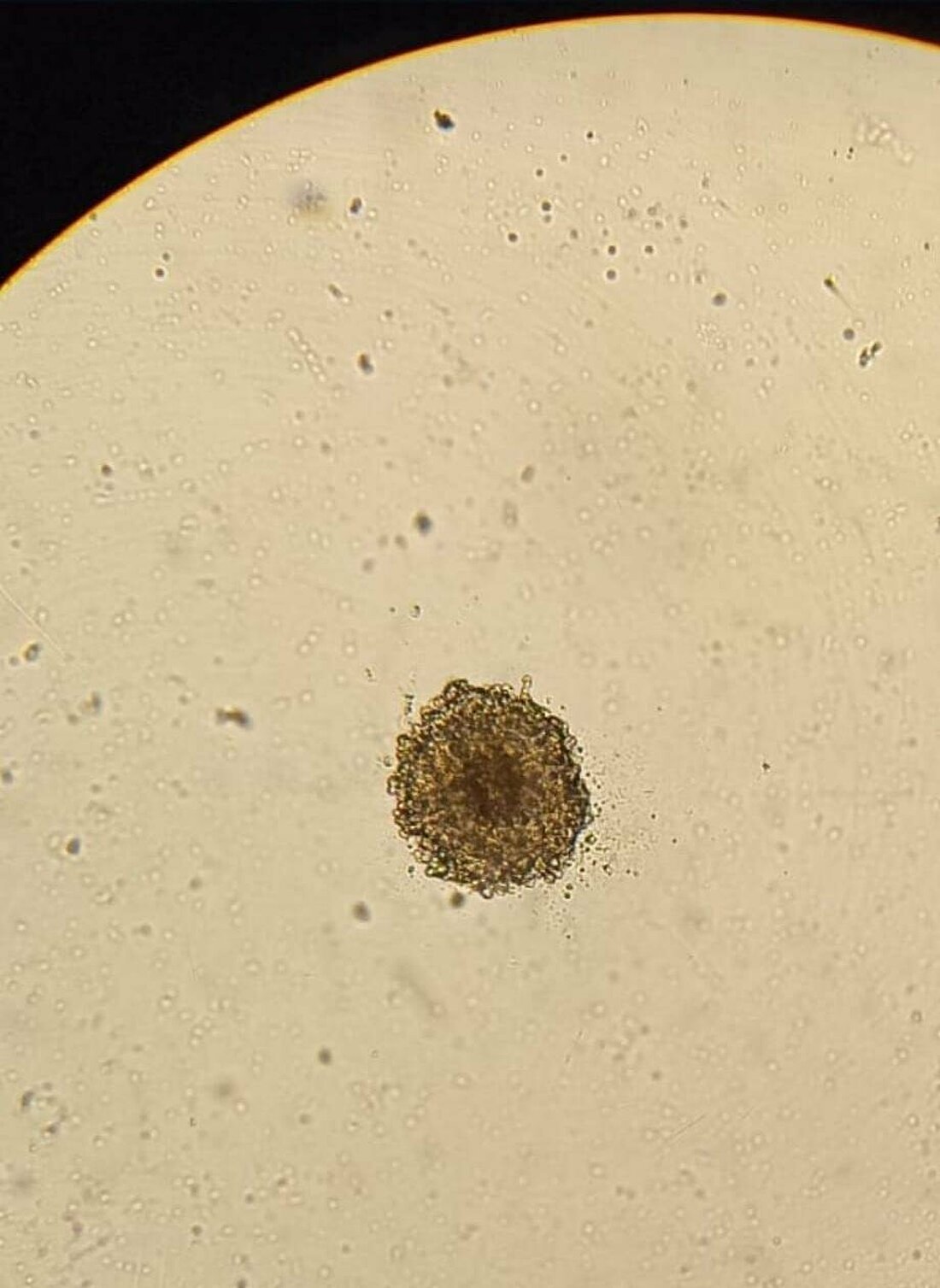 Spheroid unter dem Lichtmikroskop (Foto: Anastassija Sheremet) Zu sehen ist ein Blick durch ein Mikroskop