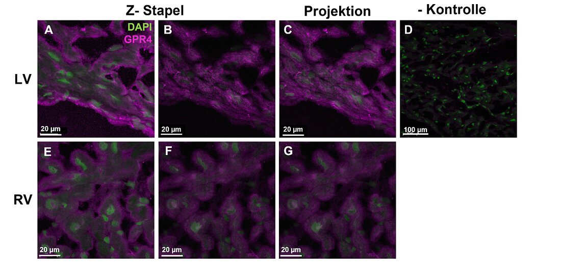 Man sieht das Protein GPR4 unter dem Mikroskop vergrößert am Rand der Zelle. In der oberen Reihe ist der linke Herzmuskel zu sehen, wo die Verteilung des Proteins deutlich zu erkennen ist. Im Vergleich dazu ist in der unteren Reihe die Abbildung schwächer. 
