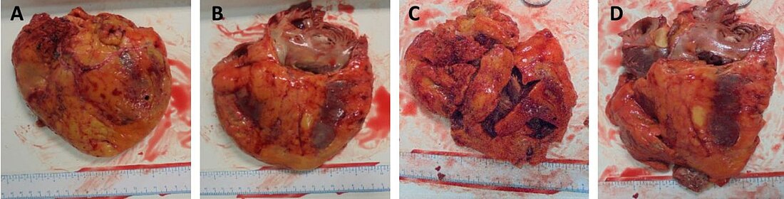Man sieht vier explantierte Herzen nebeneinander aufgereiht. 