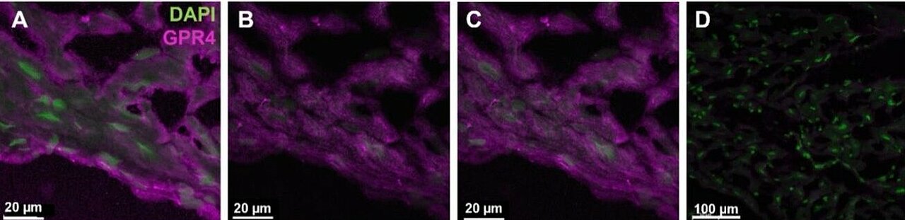 Man sieht ein Mikroskopbild, welches die Proteinverteilung in den Herzkammern aufzeigt. 